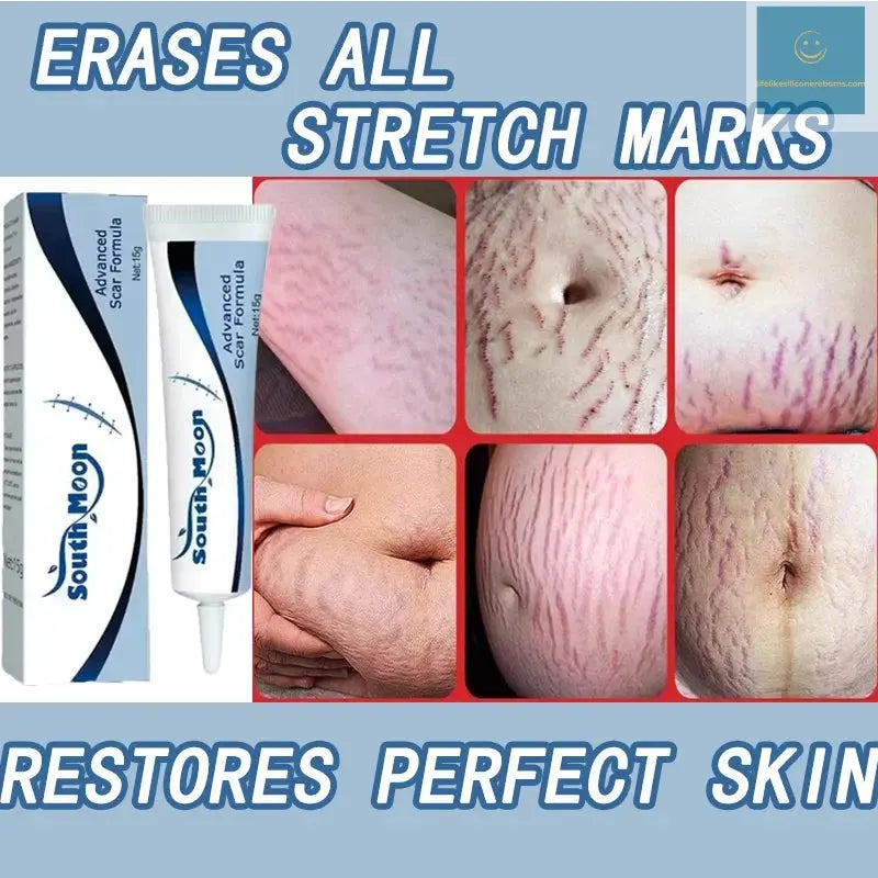 7 Days Stretch Marks cream For Pregnancy Remove Postpartum Obesity Women Scar Without Side Effect Butt Firm Lift Skin Body Cream lifelikesiliconereborns.com