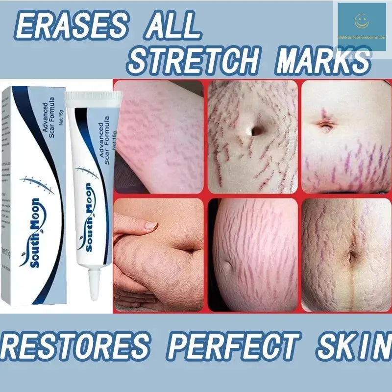 7 Days Stretch Marks cream For Pregnancy Remove Postpartum Obesity Women Scar Without Side Effect Butt Firm Lift Skin Body Cream lifelikesiliconereborns.com