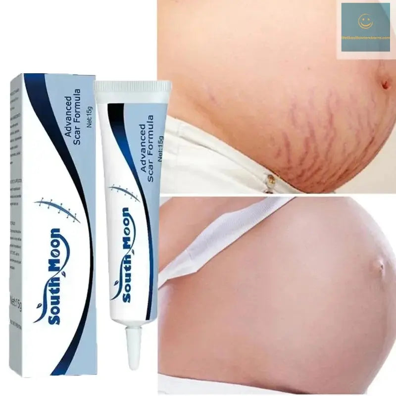 7 Days Stretch Marks cream For Pregnancy Remove Postpartum Obesity Women Scar Without Side Effect Butt Firm Lift Skin Body Cream lifelikesiliconereborns.com