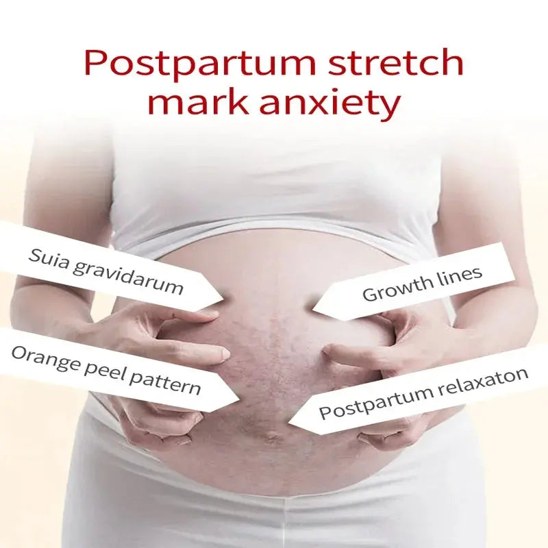 7 Days Stretch Marks cream For Pregnancy Remove Postpartum Obesity Women Scar Without Side Effect Butt Firm Lift Skin Body Cream lifelikesiliconereborns.com