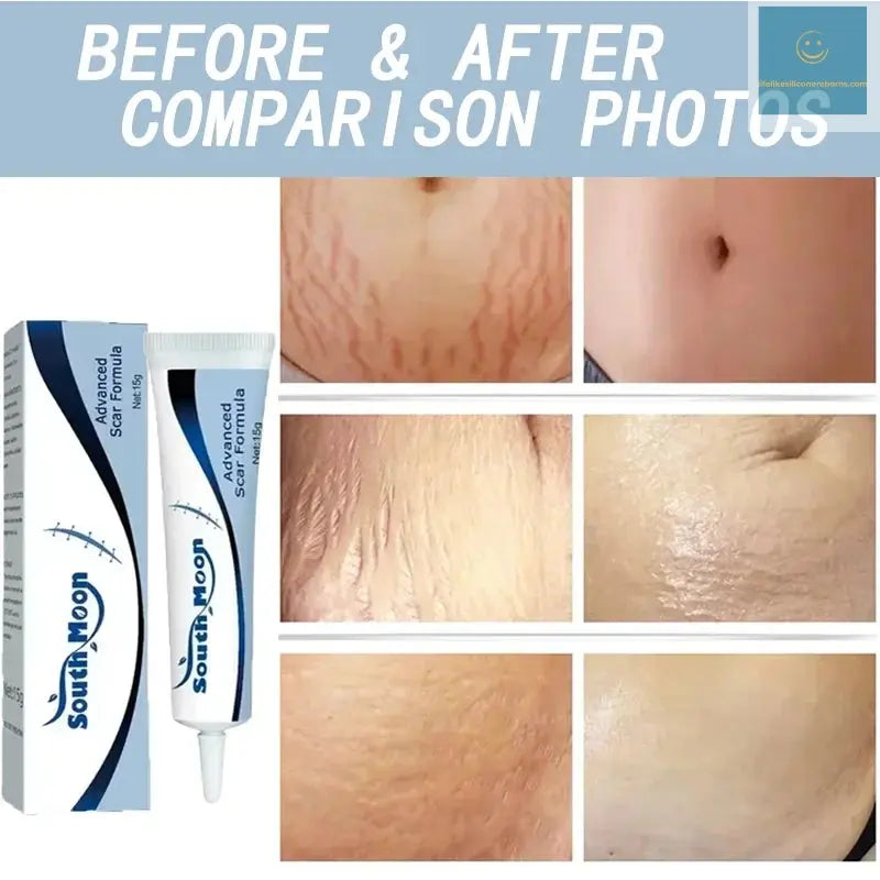 7 Days Stretch Marks cream For Pregnancy Remove Postpartum Obesity Women Scar Without Side Effect Butt Firm Lift Skin Body Cream lifelikesiliconereborns.com
