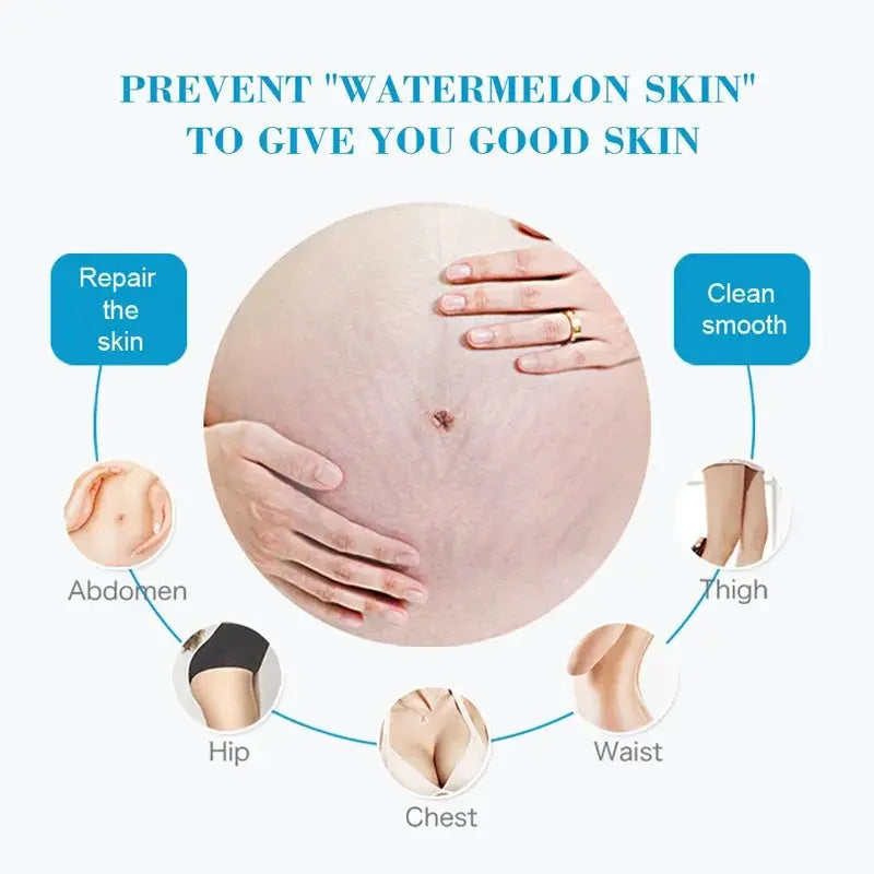 7 Days Stretch Marks cream For Pregnancy Remove Postpartum Obesity Women Scar Without Side Effect Butt Firm Lift Skin Body Cream lifelikesiliconereborns.com