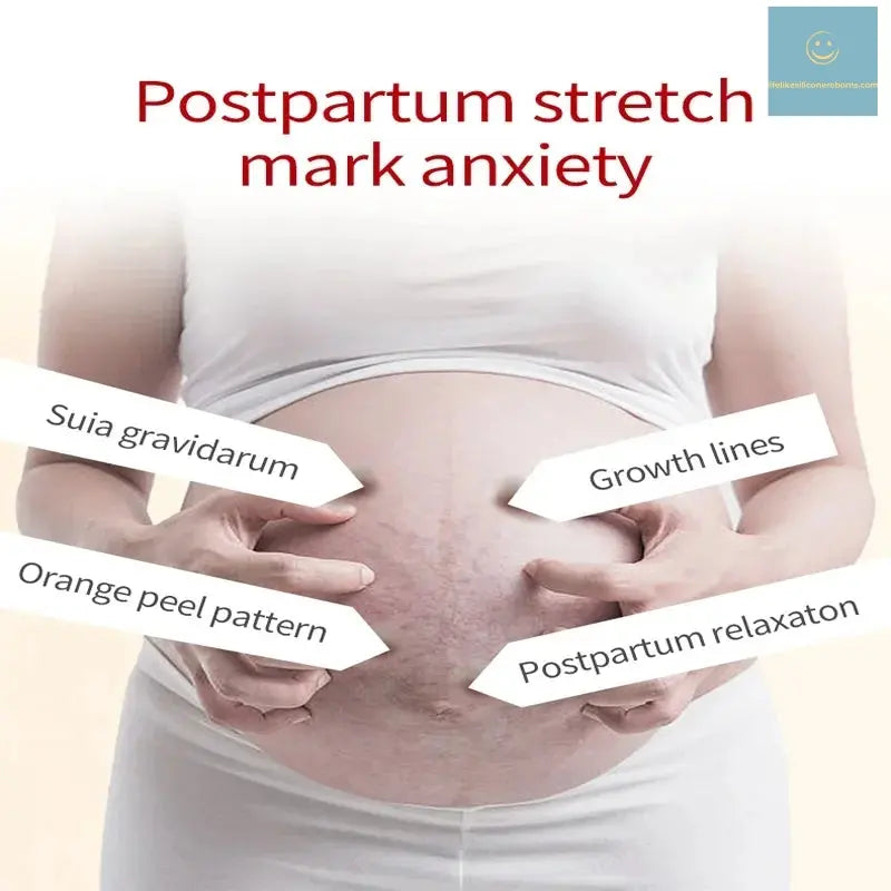7 Days Stretch Marks cream For Pregnancy Remove Postpartum Obesity Women Scar Without Side Effect Butt Firm Lift Skin Body Cream lifelikesiliconereborns.com